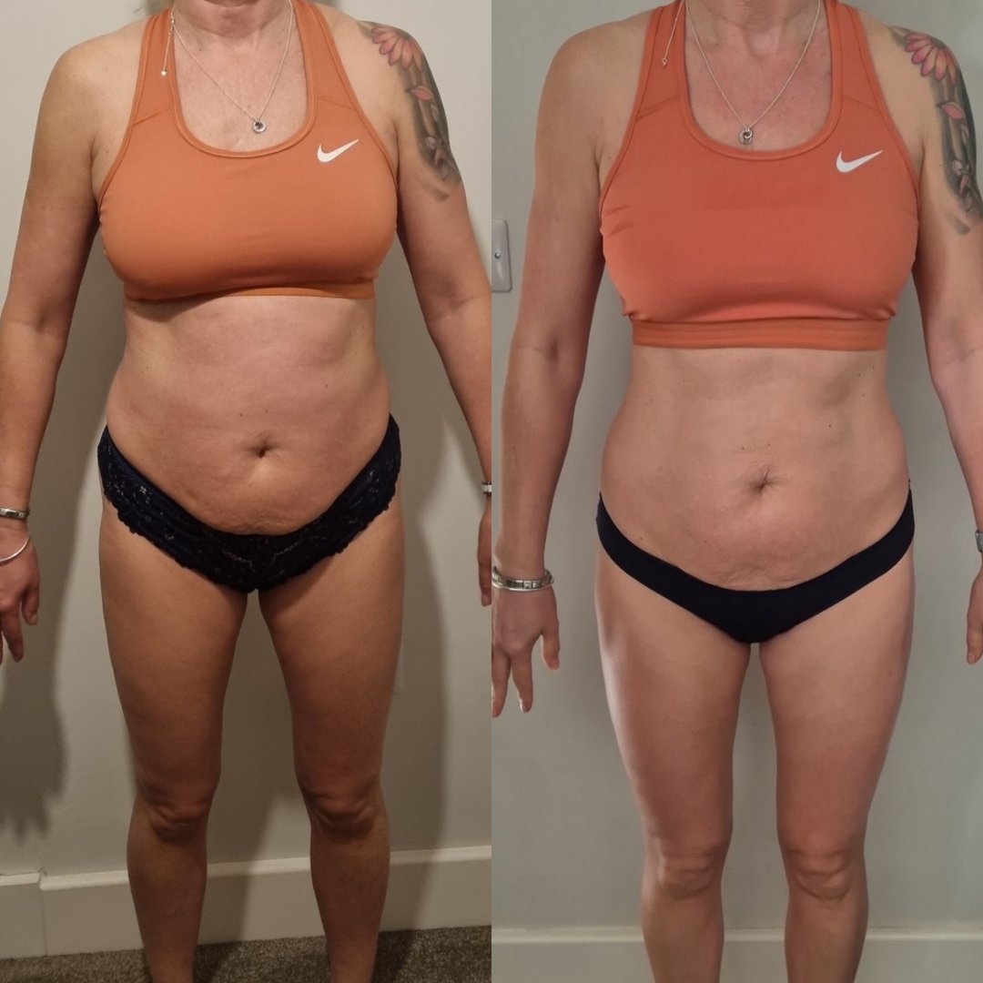 Liposomal Glutathione