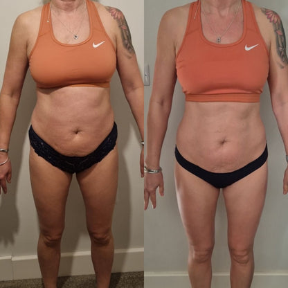 Liposomal Glutathione