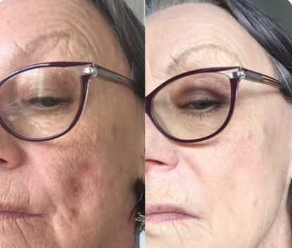 Liposomal Glutathione