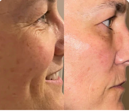 Liposomal Glutathione